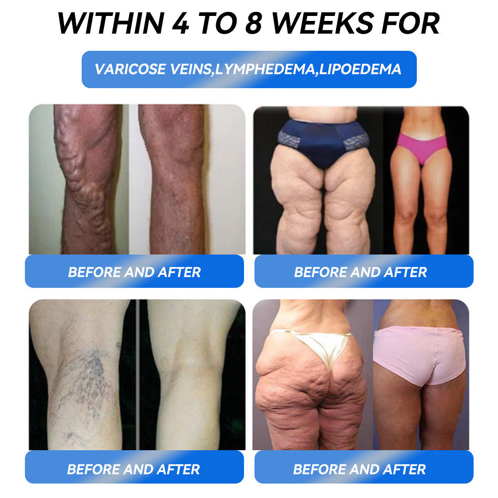 IFMAGIC® GLP-1 Pro Weight Loss Oral Solution💧Beaumont Hospital Doctor Recommendations👩⚕️Suitable for chronic diseases, obesity, diabetes, cardiovascular diseases👍